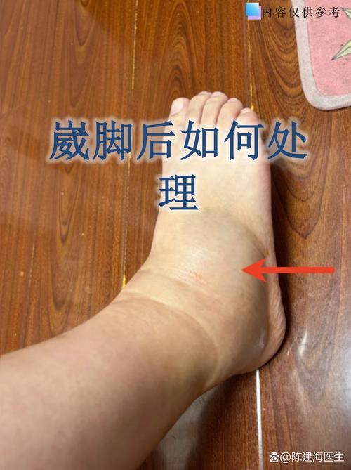 队记：迪恩韦德热身时疑似扭伤了脚踝目前不清楚伤势程度